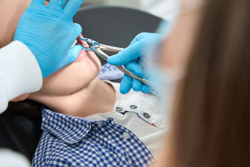 Cuidados postoperatorios después de una extracción dental: mantén tu sonrisa saludable
